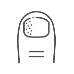 Körömgomba kezelés